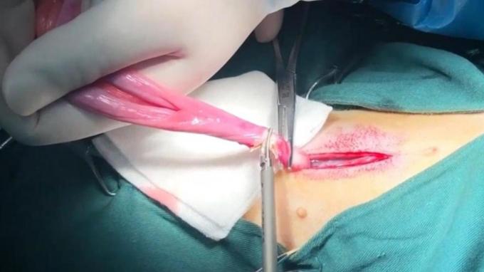 kasus perusahaan terbaru tentang Menggunakan Pisau Bedah Ultrasonik Hewan Peliharaan Dalam Operasi Cat Spay Dan Neuter | Surgsci 0