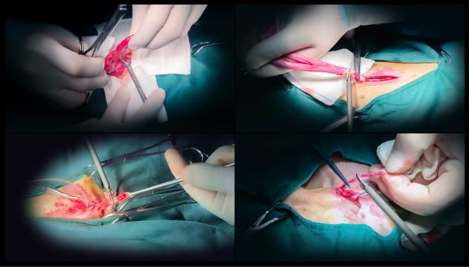 Bedah Laparoskop Sistem Pisau Bedah Ultrasonik Hemostasis Untuk Penggunaan Hewan 6