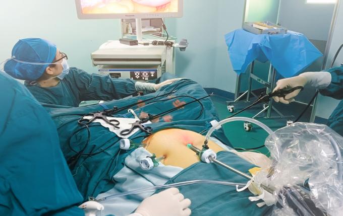 Instrumen Laparoskopi Trocar Berbilah Sekali Pakai Kelas II Sekali Pakai 1