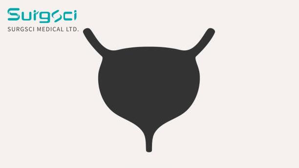 berita perusahaan terbaru tentang Klasifikasi Klinis Tuberkulosis Urin  0